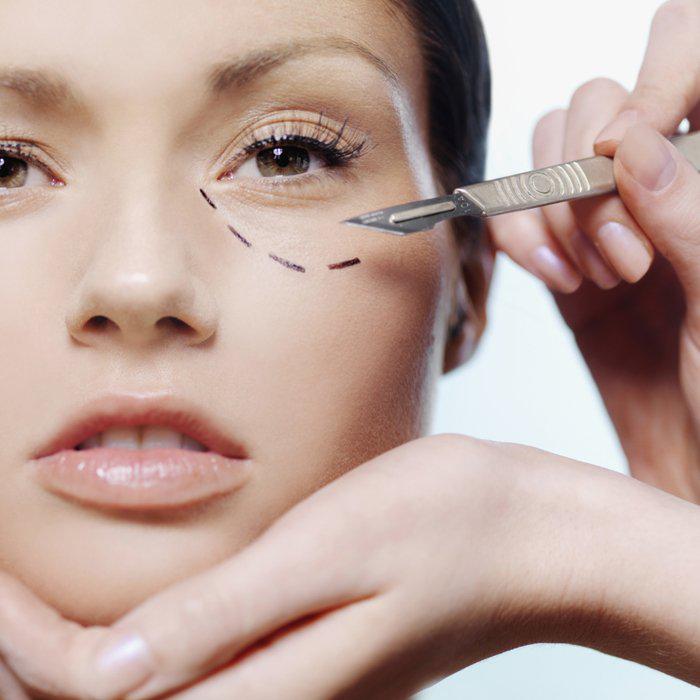 Lipofilling